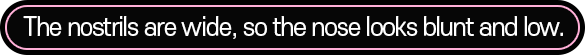 The nostrils are wide, so the nose looks blunt and low.
