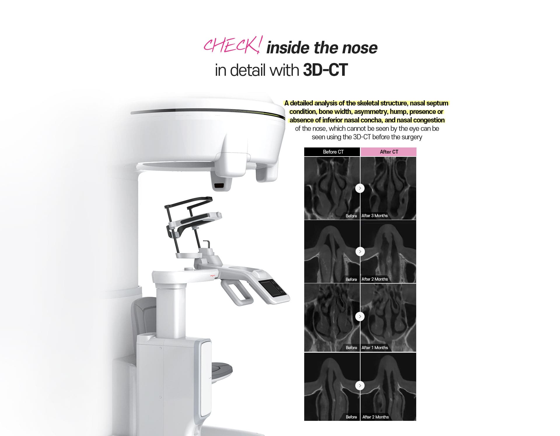 Check inside the nose in detail with 3D-CT