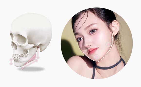 DA Shaping V-line image