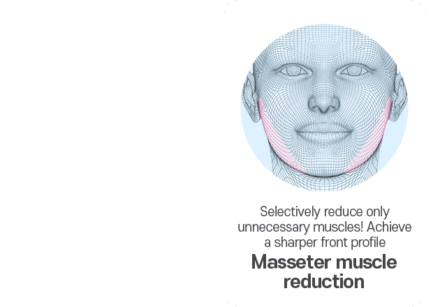 Masseter muscle reduction