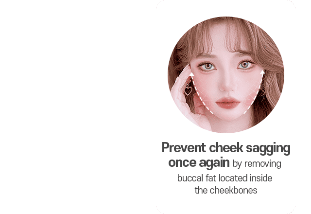 Prevent cheek sagging once again by removing buccal fat located inside the cheekbones