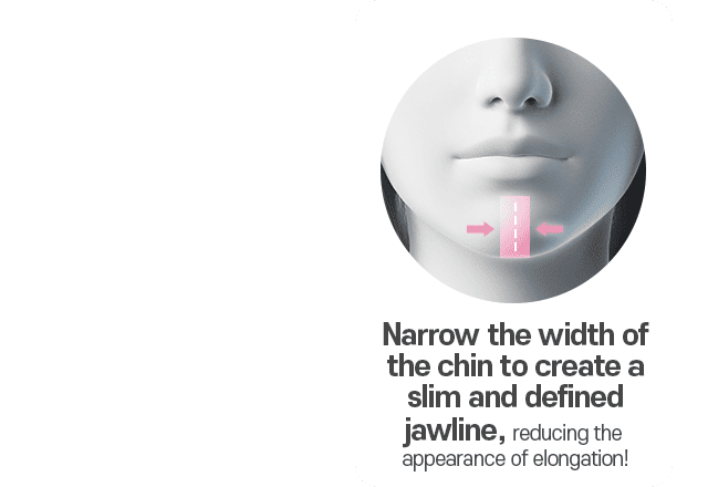 Narrow the width of the chin to create a slim and defined jawline, reducing the appearance of elongation!