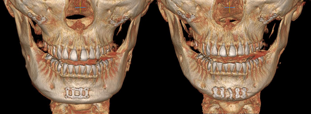 Revision difficulty level 2 view images