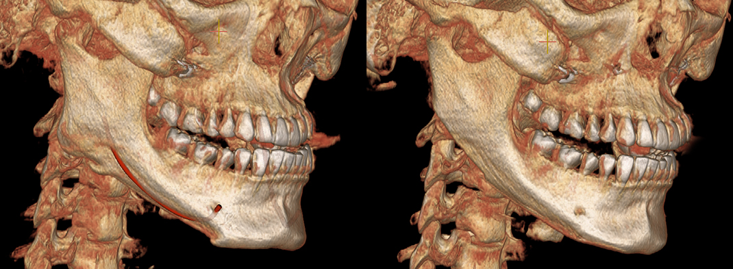 Revision difficulty level 3 view images