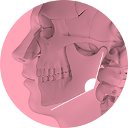 Angle of the prominent jaw image