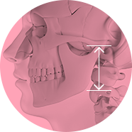 The distance between the mandible and the earlobe image