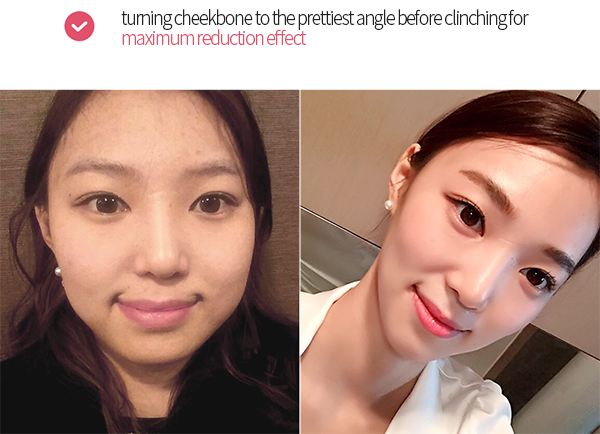 turning cheekbone to the prettiest angle before clinching for maximum reduction effect