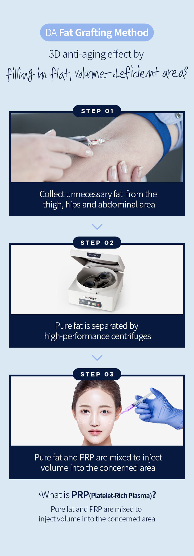 DA Fat Grafting Method, 3D anti-aging effect by filling in flat, volume-deficient areas