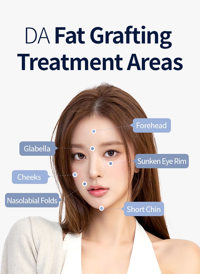 DA Fat Grafting Treatment Areas