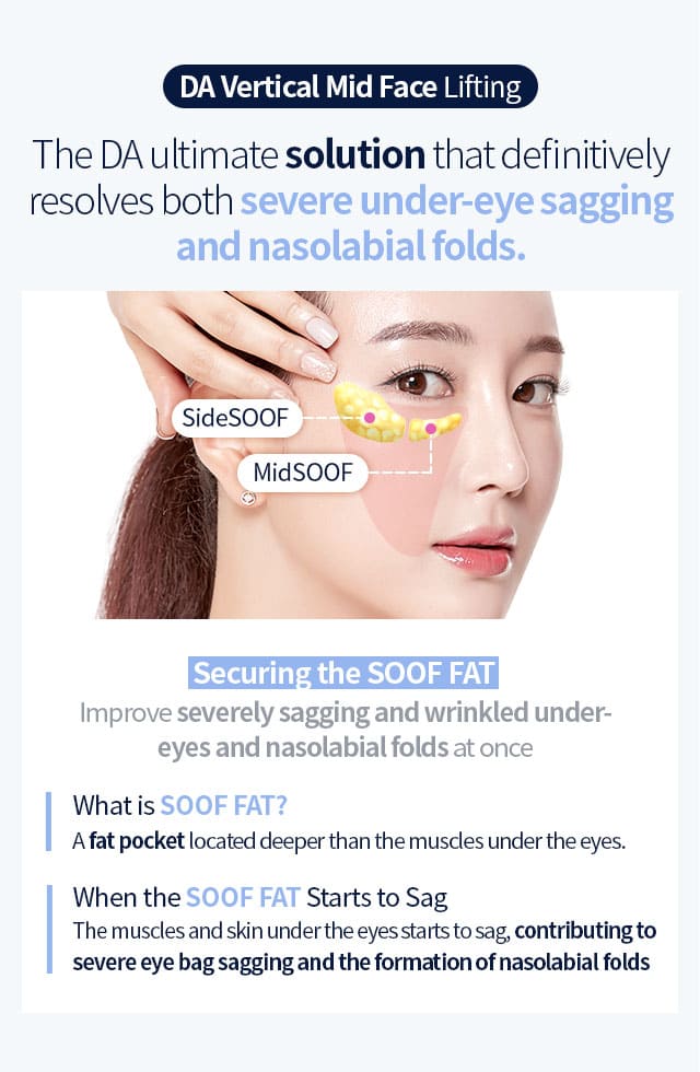 DA Vertical Mid Face Lifting, The DA ultimate solution that definitively resolves both severe under-eye sagging and nasolabial folds.