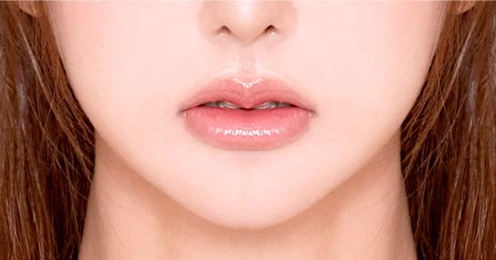 DA LIP CORNER SURGERY