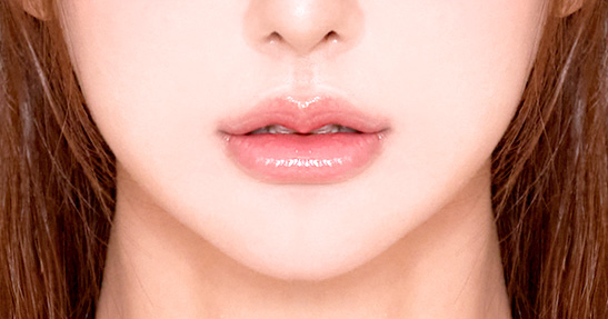 DA LIP CORNER SURGERY