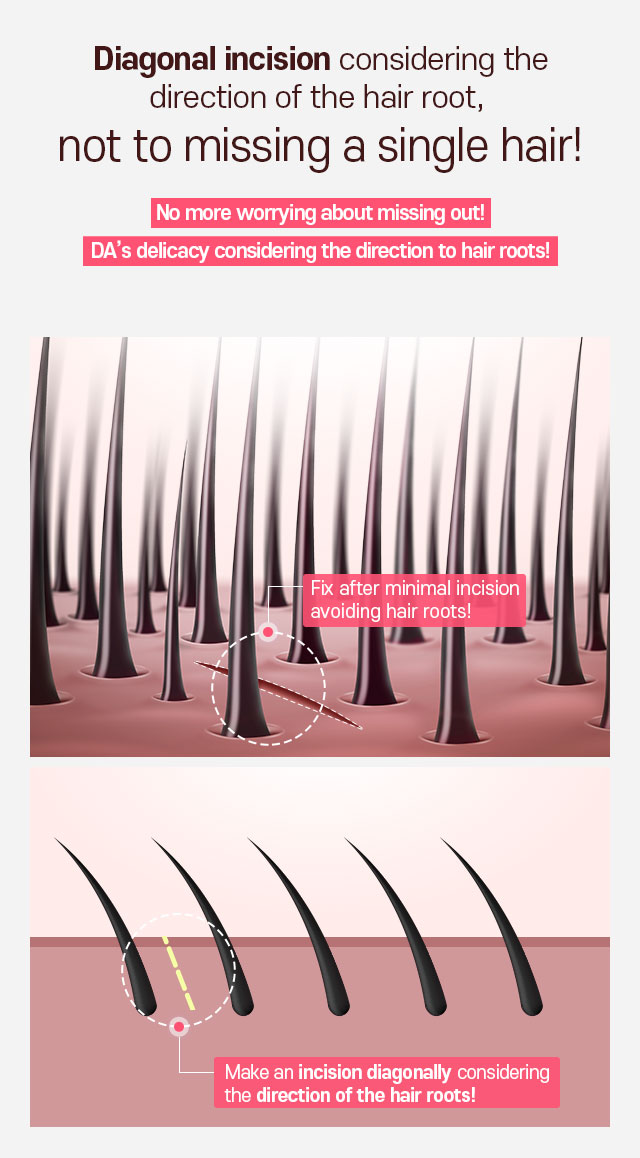 No more worrying about missing out! DA’s delicacy considering the direction to hair roots!