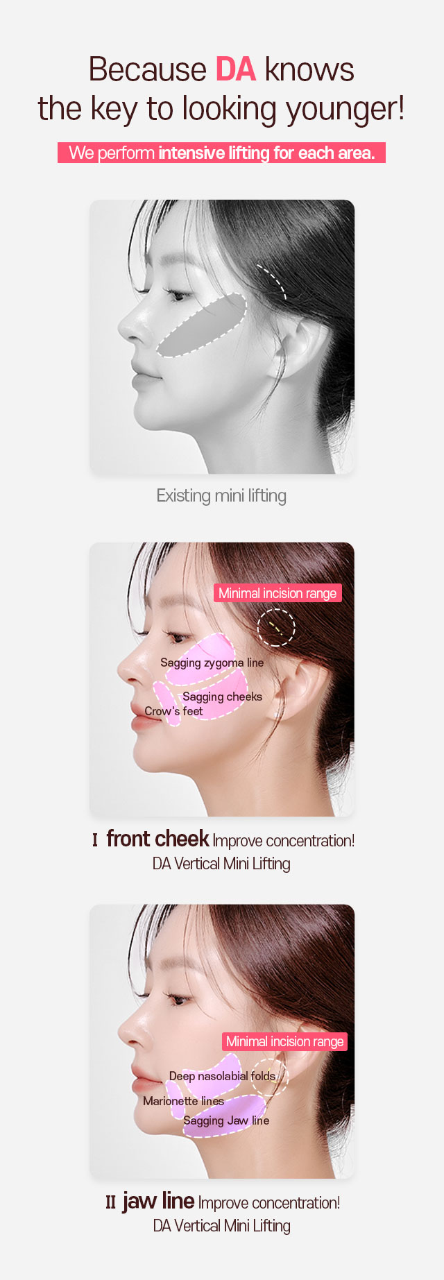 Because DA knows the key to looking younger! We perform intensive lifting for each area.