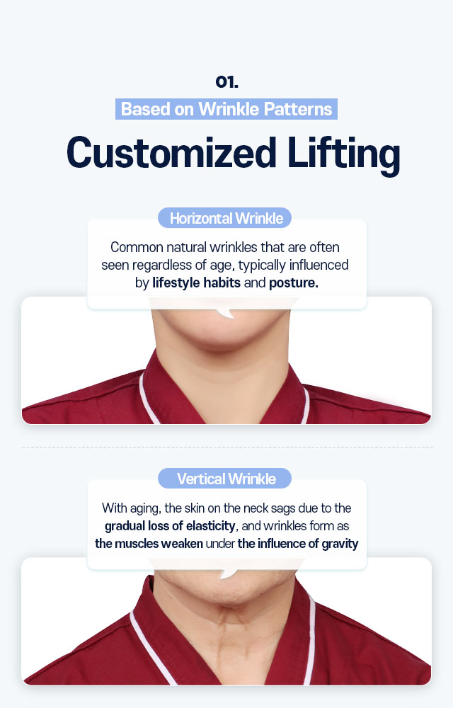 Based on Wrinkle Patterns Customized Lifting