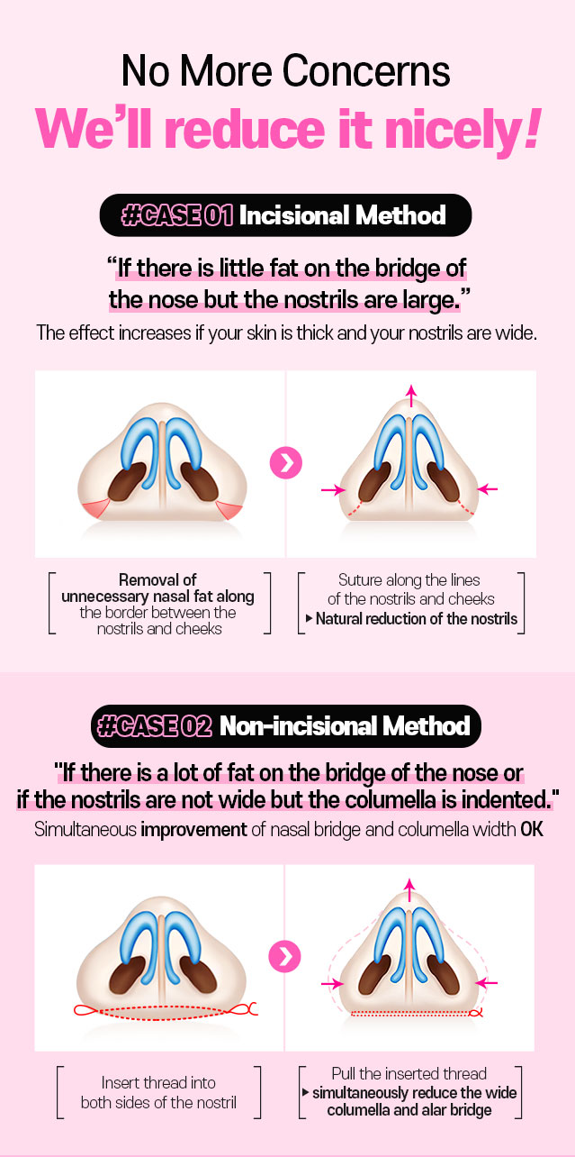 No More Concerns We’ll reduce it nicely!