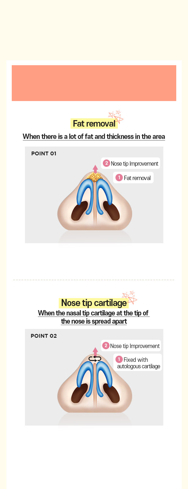 DA Bulbous Nose Correction