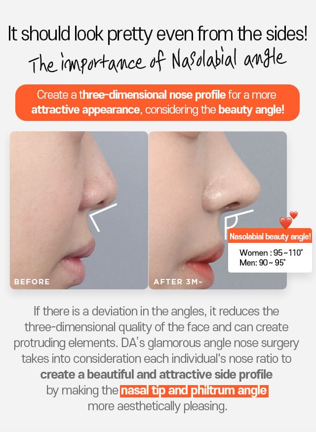 It should look pretty even from the sides! the importance of nasolabial angle