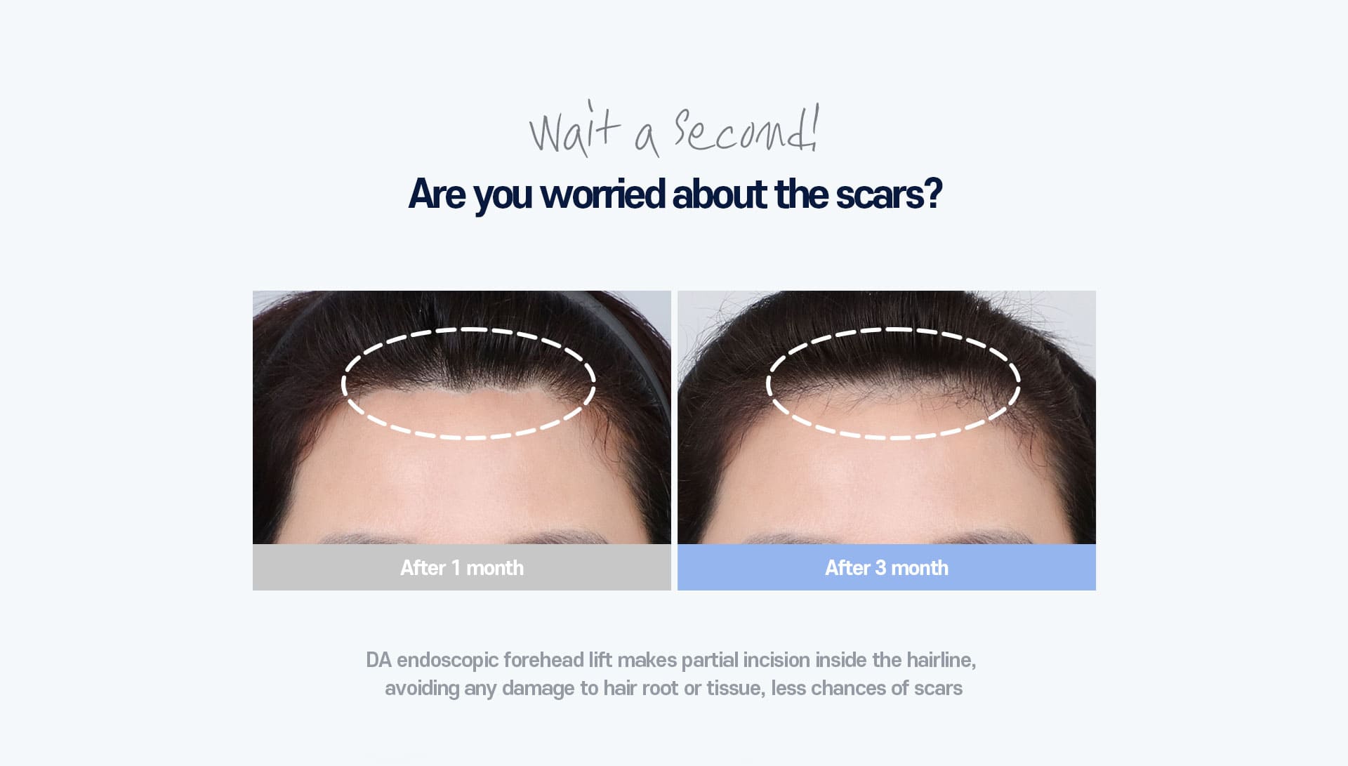 Wait a second! Are you worried about the scars?