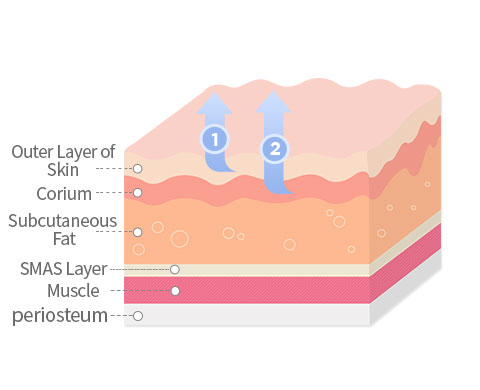 Lifting Only the Skin image