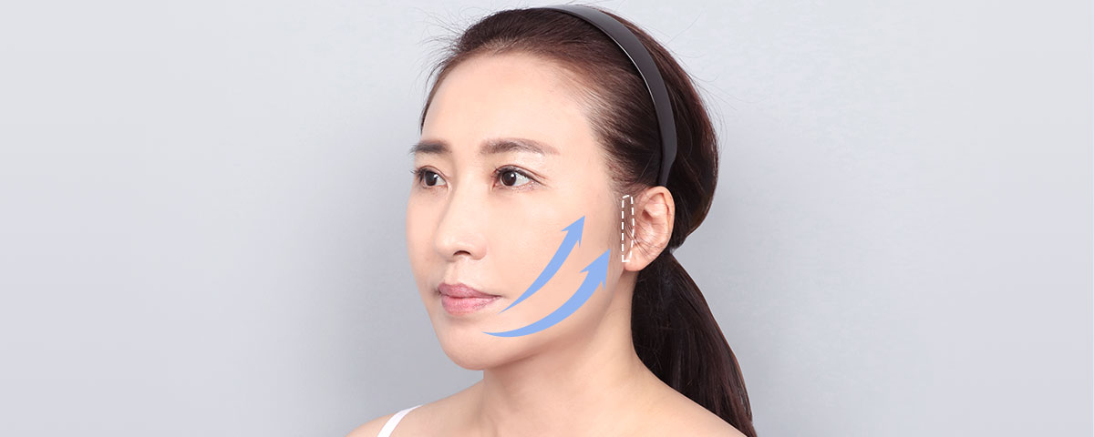 DA Full Face Lifting model image