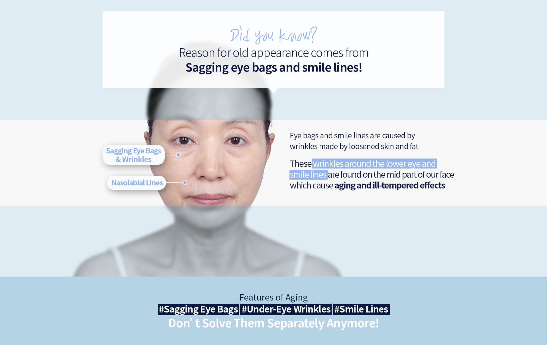 DA Vertical Mid Face Lifting