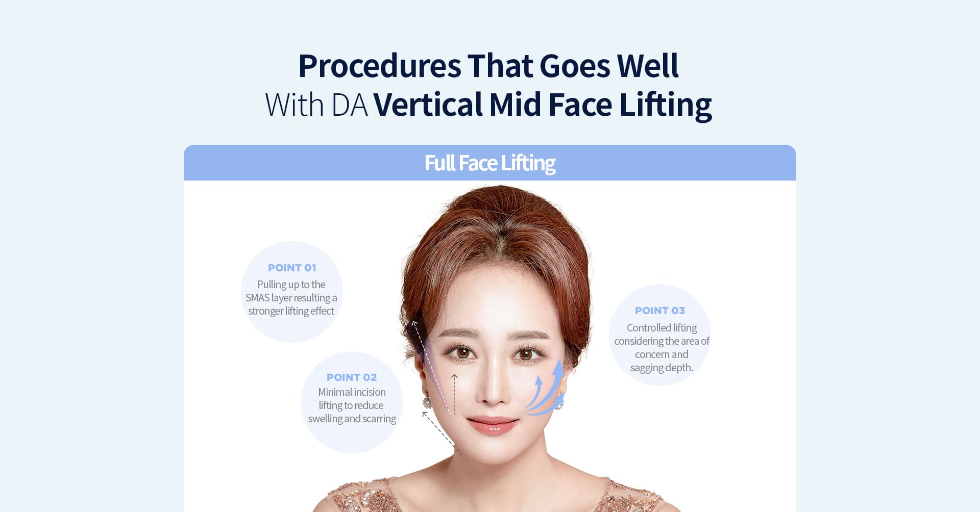 DA Vertical Mid Face Lifting