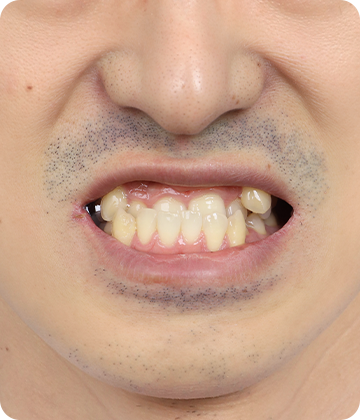 MAKE ME MAN model image