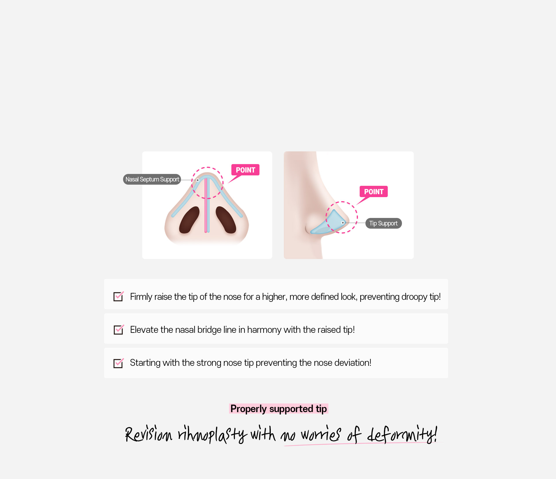 DA Revision Rhinoplasty