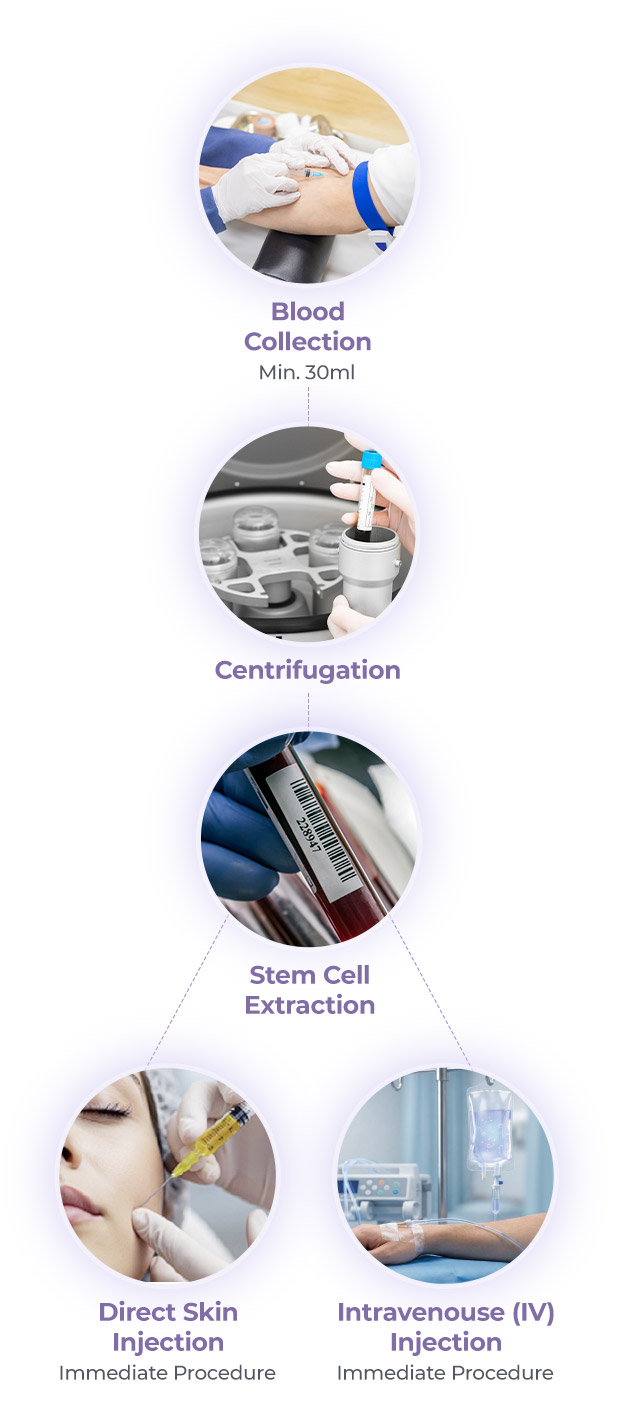 The processes of DA Blood-Derived Stem Cell Therapy