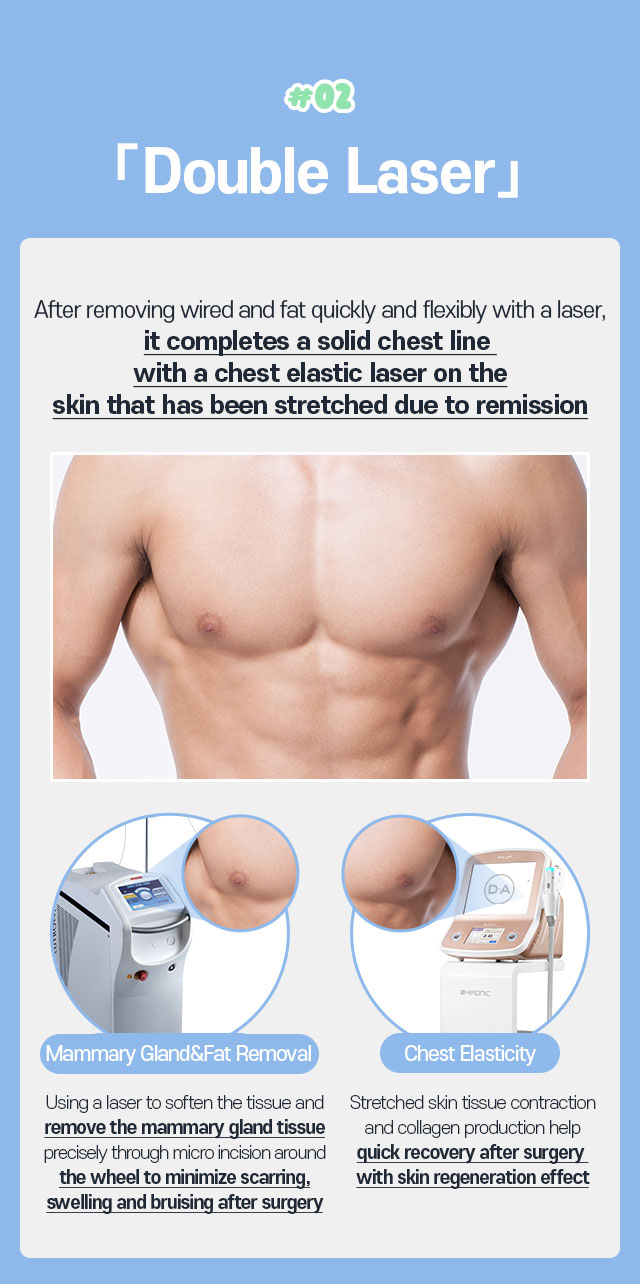 Double Gynecomastia