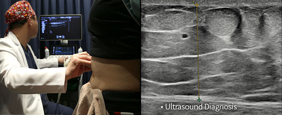 Ultrasound Diagnosis