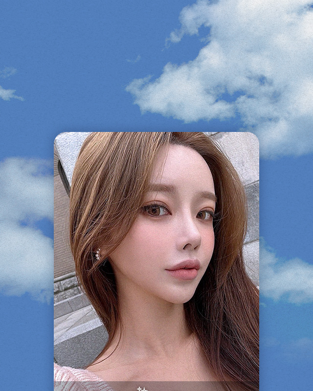 DA Under Eye Fat Repositioning