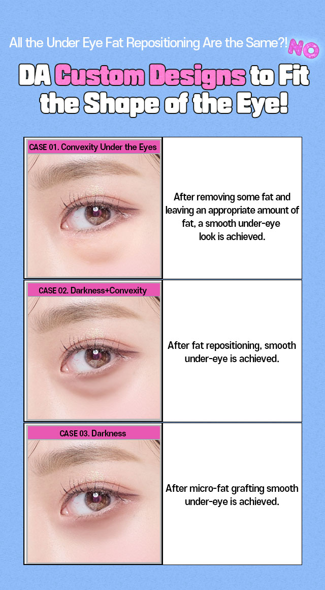 DA Under Eye Fat Repositioning