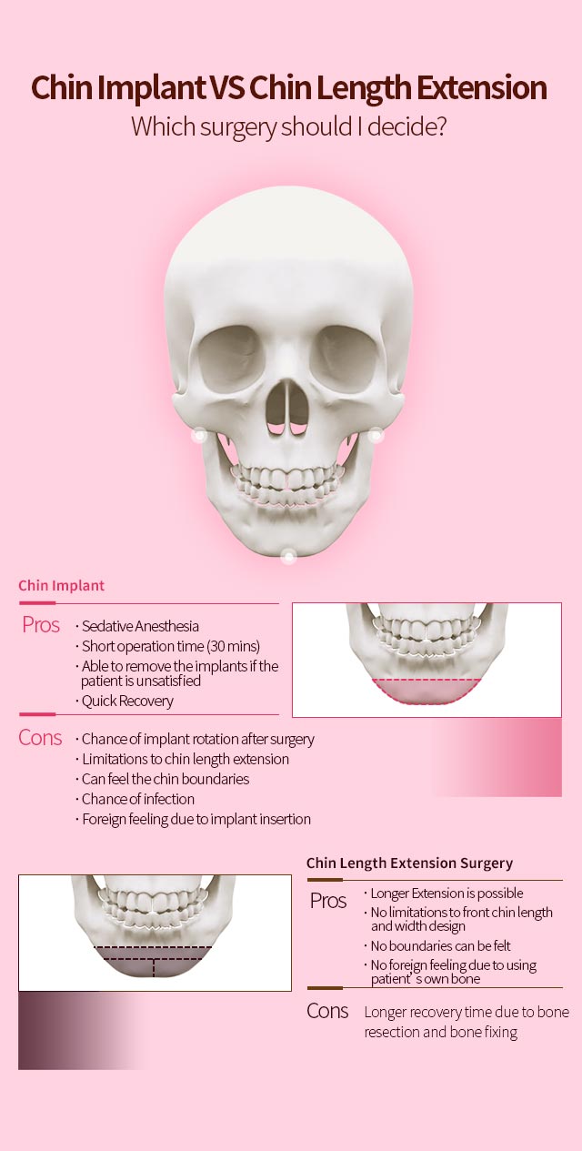 Chin Implant VS Chin Length ExtensionWhich surgery should I decide?