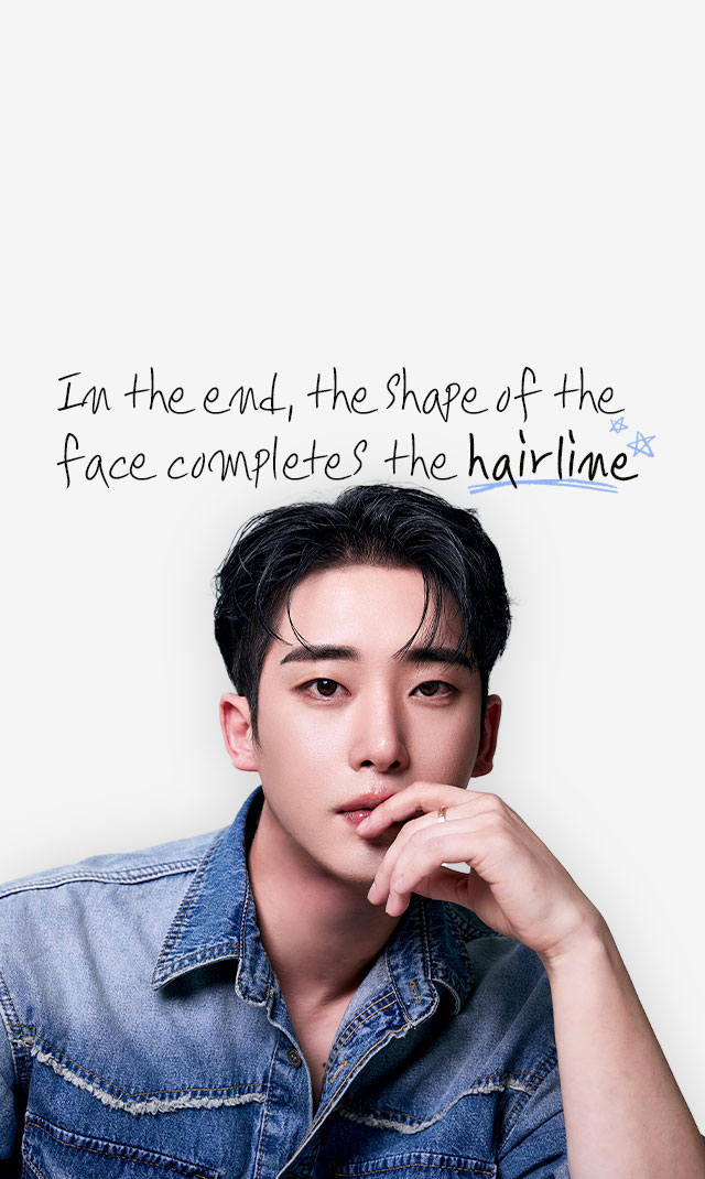 DA’s Hairline hair transplant