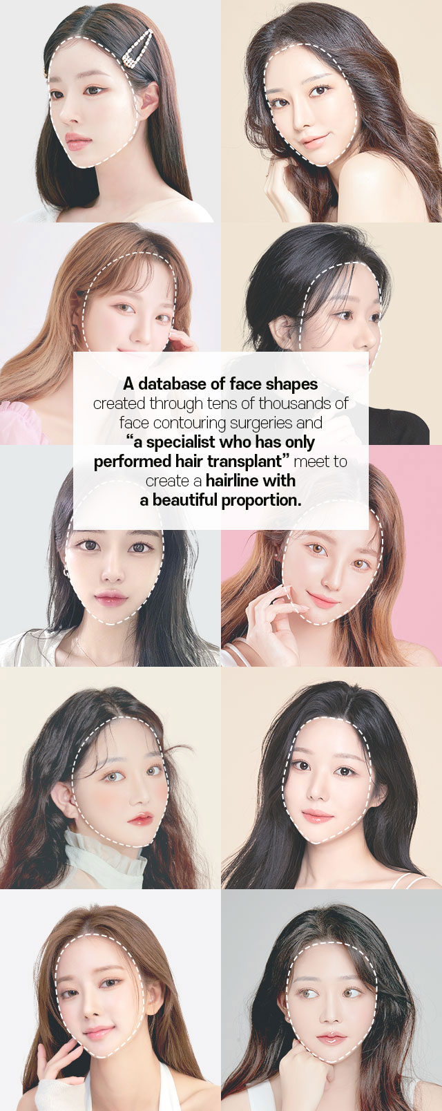 A database of face shapes created through tens of thousands of face contouring surgeries and a specialist who has only performed hair transplant meet to create a hairline with a beautiful proportion