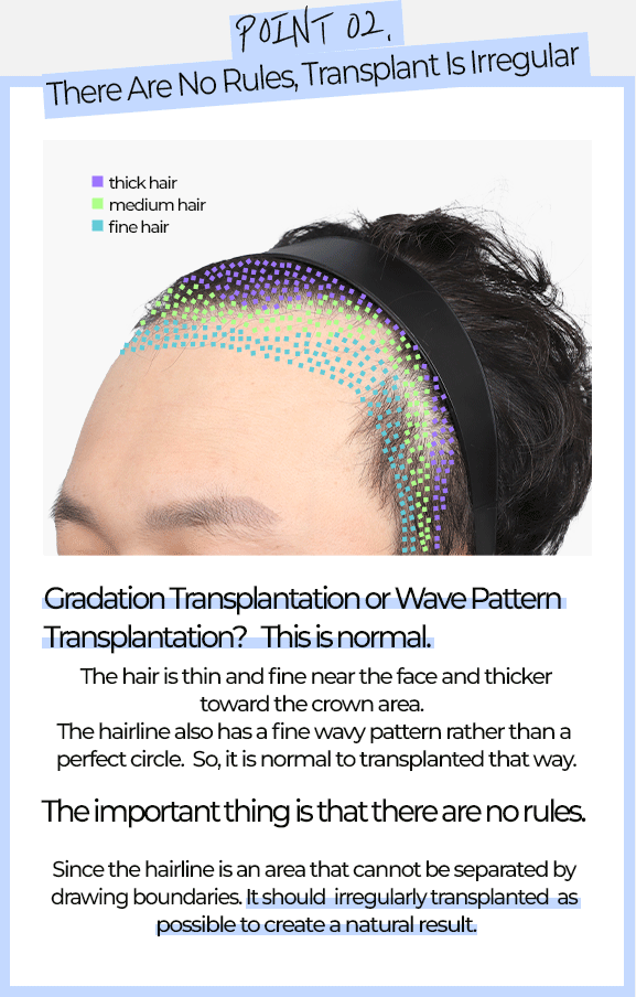 POINT02. There Are No Rules, Transplant Is Irregular