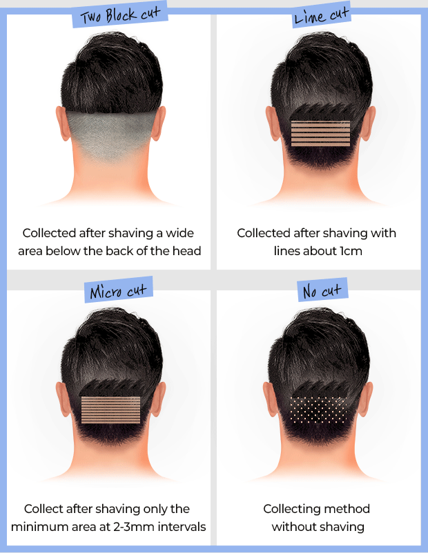 DA Hair Follicle Collecting Method Non-incision