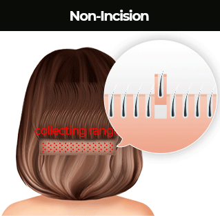 Non-incision