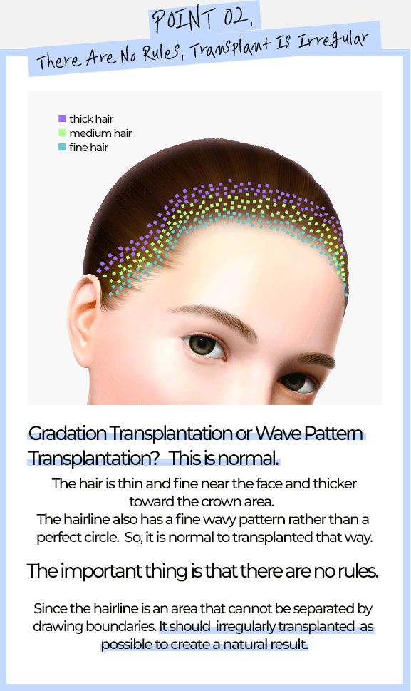 POINT02. There Are No Rules, Transplant Is Irregular