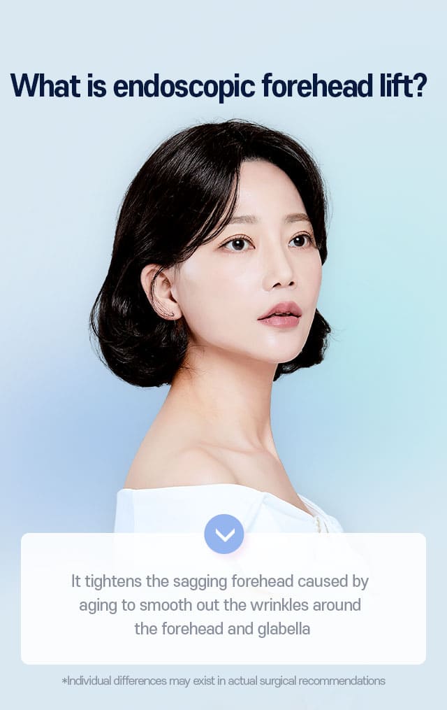 What is endoscopic forehead lift?