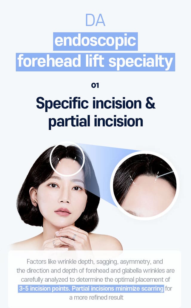 DA endoscopic forehead lift specialty - 01.Specific incision & partial incision