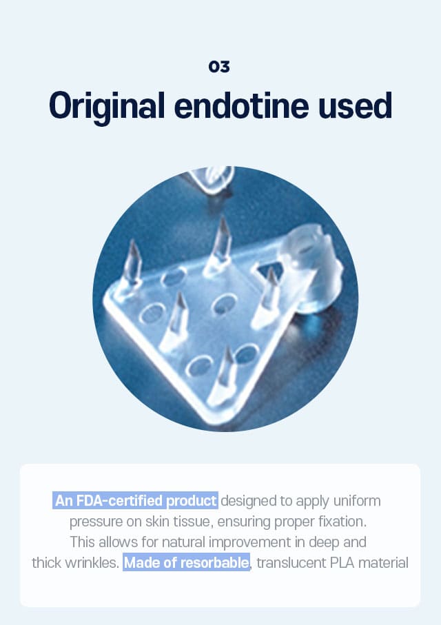 DA Endoscopic Forehead Lift specialty - 03.Original endotine used