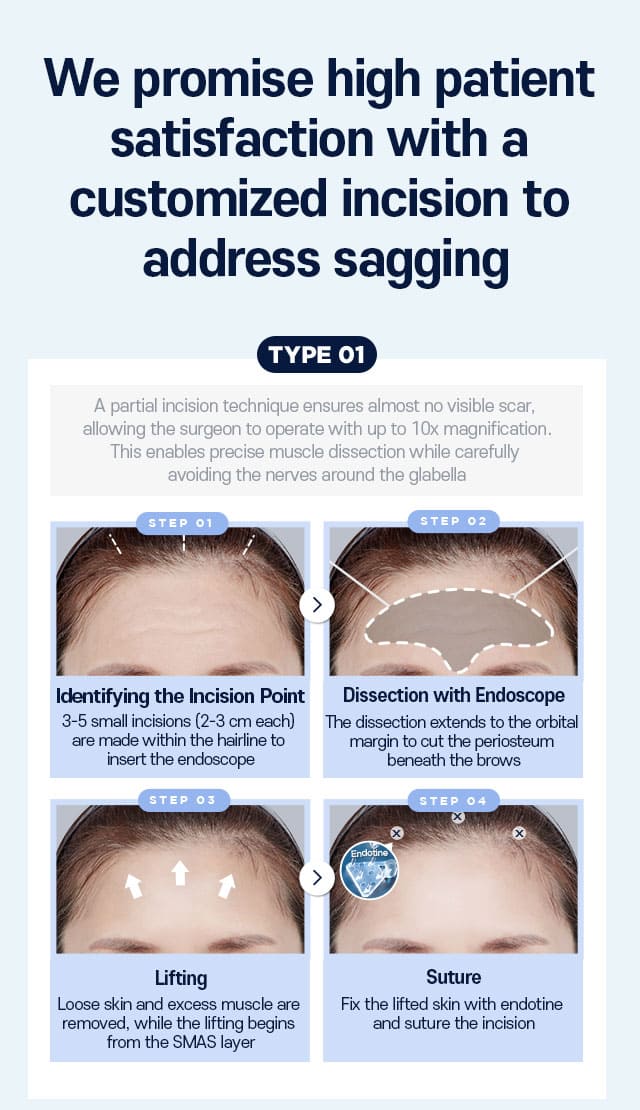 Customized incision surgery Type01