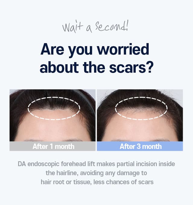 Wait a second! Are you worried about the scars?