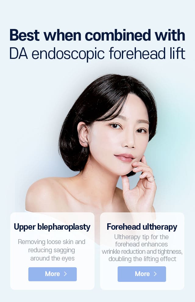 DA Endoscopic Forehead Lift Before & After