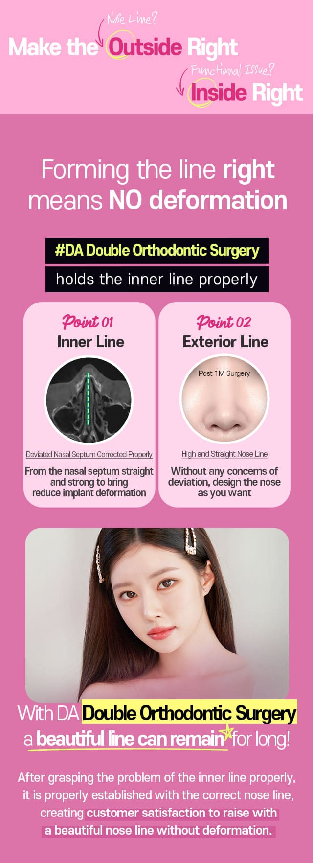 Forming the line right means NO deformation DA Double Orthodontic Surgery holds the inner line properly