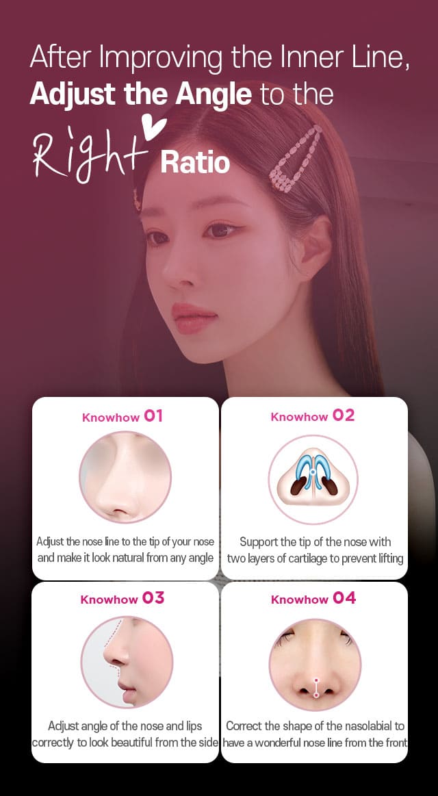 After Improving the Inner Line, Adjust the Angle to the Right Ratio