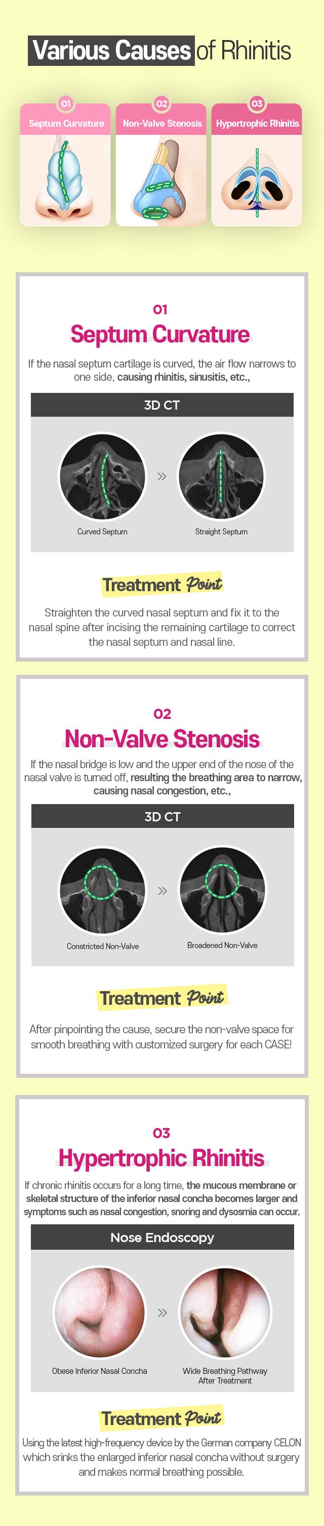 Various Causes of Rhinitis